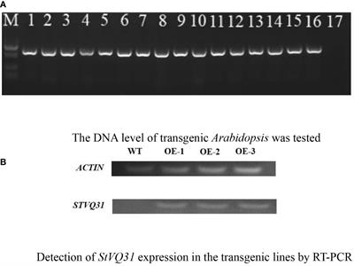 Overexpression of the potato VQ31 enhances salt tolerance in Arabidopsis